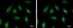 PYK2/FAK2 Antibody, Novus Biologicals 100 &mu;g; Unconjugated:Antibodies,