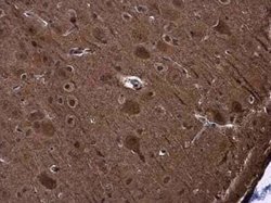 PYK2/FAK2 Antibody, Novus Biologicals 100 &mu;g; Unconjugated:Antibodies,
