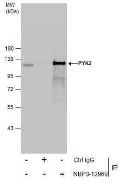 PYK2/FAK2 Antibody, Novus Biologicals 100 &mu;g; Unconjugated:Antibodies,