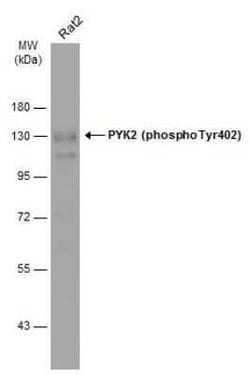 PYK2/FAK2, p Tyr402 Antibody, Novus Biologicals 100 &mu;g | Buy Online | Bio-Techne | Fisher Scientific