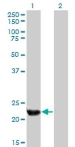 Pallidin Antibody (2H8), Novus Biologicals 0.1 mg | Buy Online | Novus Biologicals | Fisher Scientific