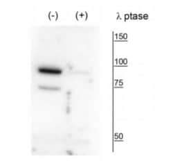 PANK4, p Thr63 Antibody, Novus Biologicals 100&mu;L:Antibodies, Polyclonal