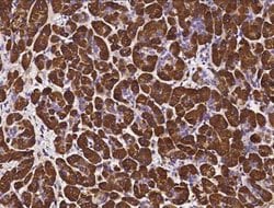 Pancreatic Lipase Rabbit anti-Human, Clone: 120, Novus Biologicals:Antibodies:Primary