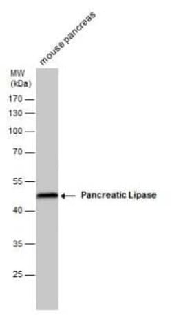 Pancreatic Lipase Antibody (GT1777), Novus Biologicals 100 &mu;g; Unconjugated:Antibodies,