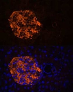 Pancreatic Lipase Related Protein 2 Antibody - Azide and BSA Free, Novus