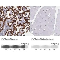 Pappalysin-1/PAPP-A Antibody, Novus Biologicals 25 &mu;L; Unconjugated:Antibodies,