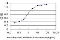 Paralemmin Antibody (7C5), Novus Biologicals 0.1 mg | Buy Online | Novus Biologicals | Fisher Scientific