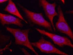 Park7/DJ-1 Antibody (007), Novus Biologicals 100 &mu;g; Unconjugated:Antibodies,