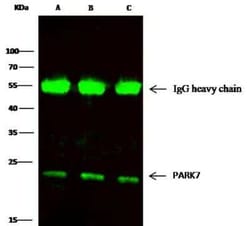 Park7/DJ-1 Antibody (007), Novus Biologicals 100 &mu;g; Unconjugated:Antibodies,