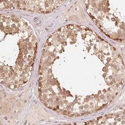 Parkin Antibody, Novus Biologicals:Antibodies:Primary Antibodies