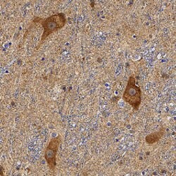 Human Parkin Antibody, R D Systems:Antibodies:Primary Antibodies
