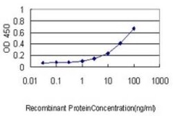 Parvin gamma Antibody (4E1), Novus Biologicals 0.05 mg | Buy Online | Novus Biologicals | Fisher Scientific
