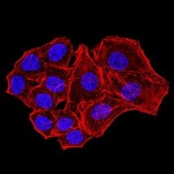 Parvovirus NS1 Antibody (8E6E10) - BSA Free, Novus Biologicals 0.1 ml;
