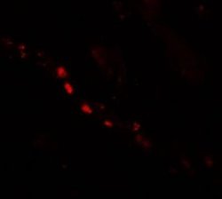 Patched Domain Containing 2 Antibody - BSA Free, Novus Biologicals 0.1 mg | Buy Online | Novus Biologicals | Fisher Scientific
