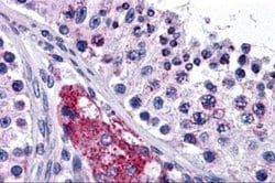 Patched Domain Containing 2 Antibody - BSA Free, Novus Biologicals 0.1