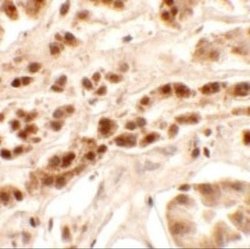 Patched Domain Containing 2 Antibody - BSA Free, Novus Biologicals 0.1 mg | Buy Online | Novus Biologicals | Fisher Scientific