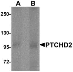 Patched Domain Containing 2 Antibody - BSA Free, Novus Biologicals 0.1 mg | Buy Online | Novus Biologicals | Fisher Scientific
