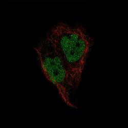 Pax2 Antibody (CL9469), Novus Biologicals 100 &mu;L; Unconjugated:Antibodies,