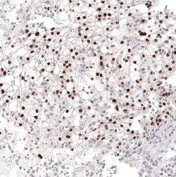 Pax2 Antibody (CL9469), Novus Biologicals 100 &mu;L; Unconjugated:Antibodies,