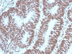 Pax2 Antibody (PAX2/1104) - Azide and BSA Free, Novus Biologicals 100 ug;