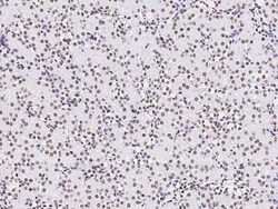 Pax2 Antibody, Novus Biologicals 50 &mu;g, Unconjugated:Antibodies, Polyclonal