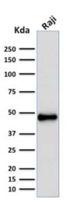 Pax5/BSAP Mouse anti-Human, Clone: rPAX5/2060, Novus Biologicals:Antibodies:Primary