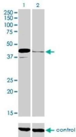 Pax5/BSAP Antibody (8F9), Novus Biologicals 0.1 mg | Buy Online | Novus Biologicals | Fisher Scientific