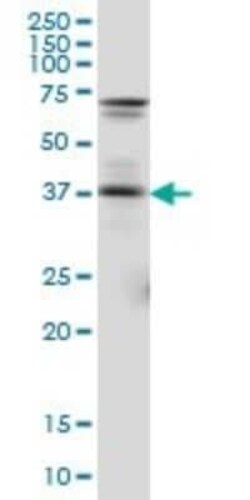 Pax5/BSAP Antibody (8F9), Novus Biologicals 0.1 mg | Buy Online | Novus Biologicals | Fisher Scientific