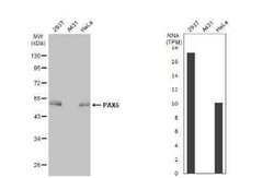 Pax6 Antibody (GT9412), Novus Biologicals 100 &mu;g; Unconjugated:Antibodies,