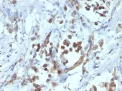 Pax6 Antibody (PAX6/1166), Novus Biologicals 0.02mg; Unlabeled:Antibodies,