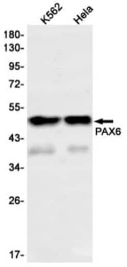 Pax6 Antibody (S01-1G8), Novus Biologicals 100 &mu;g | Buy Online | Novus Biologicals | Fisher Scientific