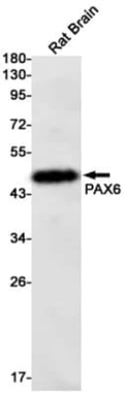 Pax6 Antibody (S03-8G4), Novus Biologicals:Antibodies:Primary Antibodies