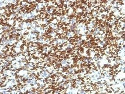 Pax7 Antibody (PAX7/1187), Novus Biologicals 0.1mg; Unlabeled:Antibodies,