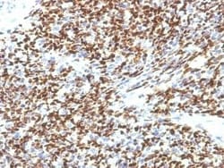 Pax7 Antibody (SPM613), Novus Biologicals:Antibodies:Primary Antibodies