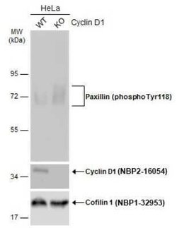 Paxillin, p Tyr118 Antibody, Novus Biologicals 100 &mu;g | Buy Online | Novus Biologicals | Fisher Scientific