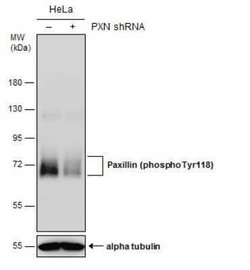 Paxillin, p Tyr118 Antibody, Novus Biologicals 100 &mu;g | Buy Online | Novus Biologicals | Fisher Scientific