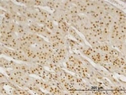 Pbx3 Antibody (1A11), Novus Biologicals 0.1 mg | Buy Online | Novus Biologicals | Fisher Scientific