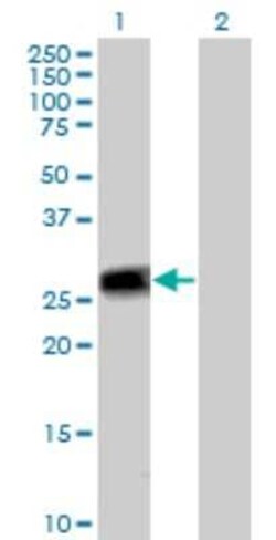 Peflin Antibody, Novus Biologicals 50 &mu;g; Unconjugated:Antibodies, Polyclonal
