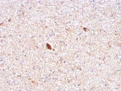 Pentraxin 2/SAP Antibody (APCS/3240) - Azide and BSA Free, Novus Biologicals