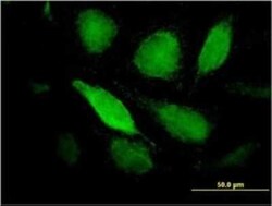 Pentraxin 3/TSG-14 Antibody (2B10), Novus Biologicals 0.1 mg | Buy Online | Novus Biologicals | Fisher Scientific