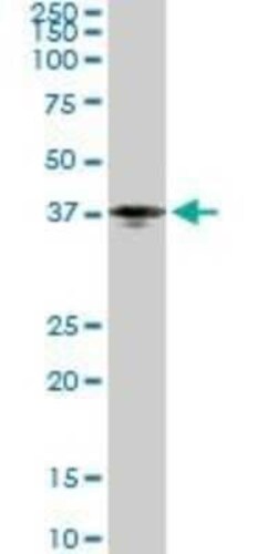 Pentraxin 3/TSG-14 Antibody (2B10), Novus Biologicals 0.1 mg | Buy Online | Novus Biologicals | Fisher Scientific
