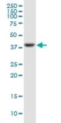 Pentraxin 3/TSG-14 Antibody (2B10), Novus Biologicals 0.1 mg | Buy Online | Novus Biologicals | Fisher Scientific