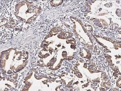 Pepsinogen A4/PGA4 Rabbit anti-Human, Clone: 21, Novus Biologicals:Antibodies:Primary