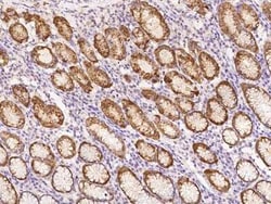 Pepsinogen C/PGC/Progastricsin Antibody, Novus Biologicals 50 &mu;g; Unconjugated:Antikörper