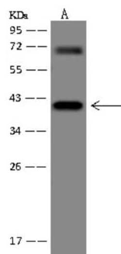 Pepsinogen C/PGC/Progastricsin Antibody, Novus Biologicals 50 &mu;g; Unconjugated:Antikörper