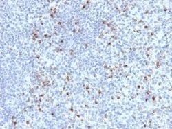 Perforin, Mouse anti-Human, Clone: PRF1/2470, Novus Biologicals 20 ug;