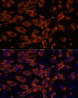 Periaxin Antibody - Azide and BSA Free, Novus Biologicals 0.02 mL; Unconjugated:Antibodies,