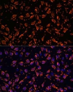 Periaxin Antibody - Azide and BSA Free, Novus Biologicals 0.02 mL; Unconjugated:Antibodies,