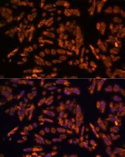 Periaxin Antibody - Azide and BSA Free, Novus Biologicals 0.02 mL; Unconjugated:Antibodies,