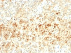 Perilipin-2/ADFP Antibody (ADFP/2755R) - Azide and BSA Free, Novus Biologicals 100 &mu;g | Buy Online | Novus Biologicals | Fisher Scientific